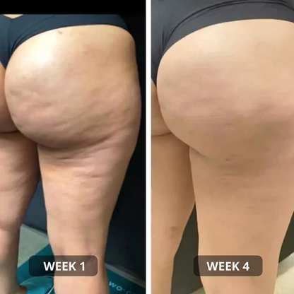 Anti-Cellulite Patches